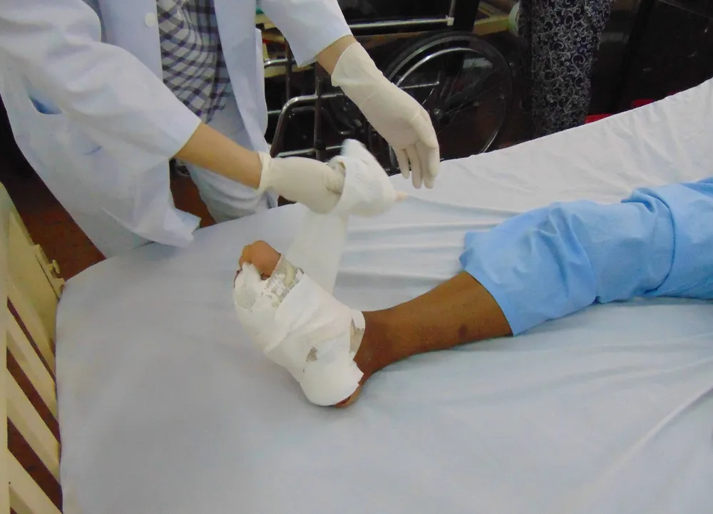 đái tháo đường bị loét bàn chân