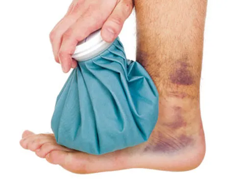 Bong gân, có nên bó thuốc? ảnh 1 Bong gân, có nên bó thuốc? ảnh 1