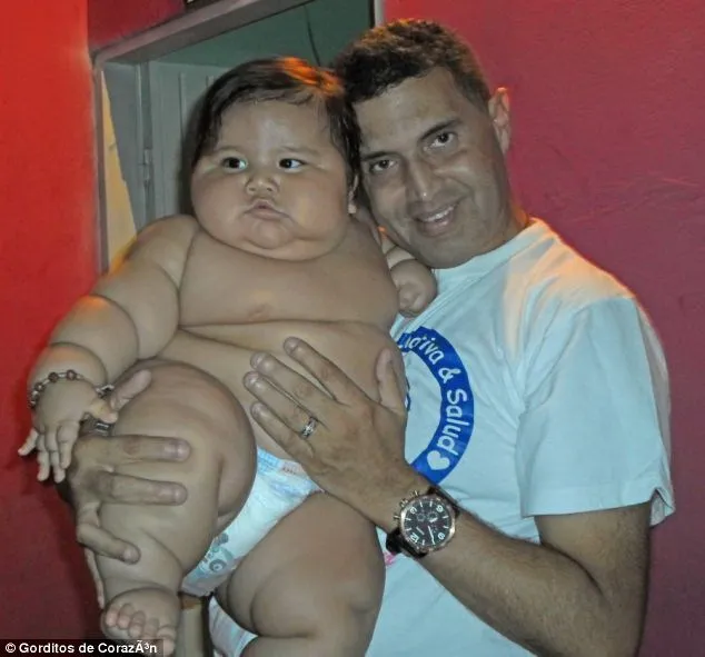 Bé trai béo nhất Colombia được điều trị giảm cân ảnh 2 Bé trai béo nhất Colombia được điều trị giảm cân ảnh 2