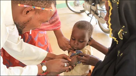 Những đại dịch sởi xảy ra trên thế giới ảnh 1