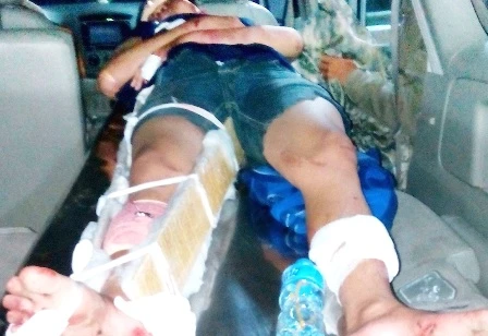 Vụ bị gia đình bạn gái còng, đánh gãy chân: Truy tố tội cố ý gây thương tích ảnh 1