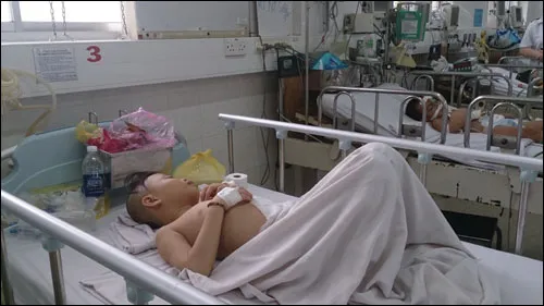 Ăn ốc ma, bé trai chín tuổi nhập viện ảnh 1 Ăn ốc ma, bé trai chín tuổi nhập viện ảnh 1