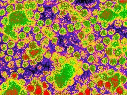 10 loại virus chết người nguy hiểm nhất thế giới ảnh 10 10 loại virus chết người nguy hiểm nhất thế giới