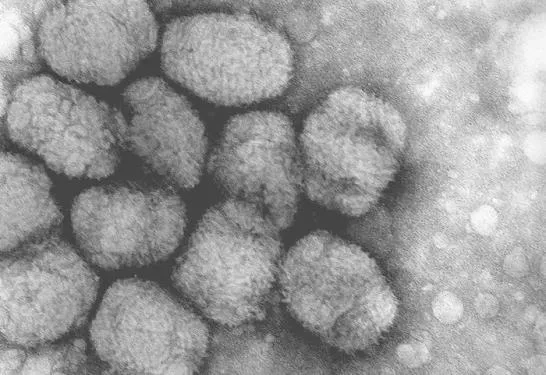 10 loại virus chết người nguy hiểm nhất thế giới ảnh 4 10 loại virus chết người nguy hiểm nhất thế giới