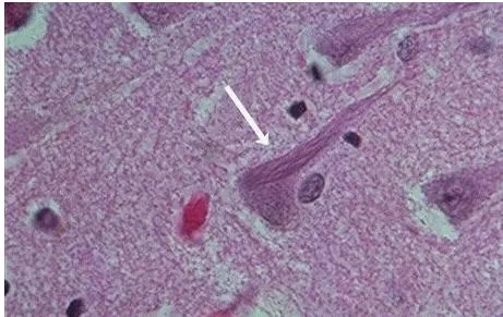10 loại virus chết người nguy hiểm nhất thế giới ảnh 7 10 loại virus chết người nguy hiểm nhất thế giới