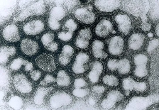 10 loại virus chết người nguy hiểm nhất thế giới ảnh 9 10 loại virus chết người nguy hiểm nhất thế giới