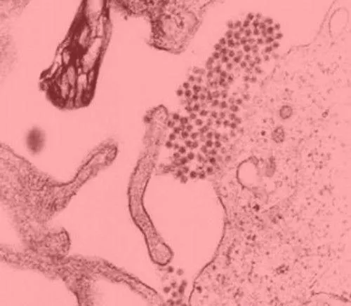 10 loại virus chết người nguy hiểm nhất thế giới ảnh 8 10 loại virus chết người nguy hiểm nhất thế giới