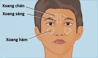 Các vị trí xoang dễ bị viêm ở trẻ em.