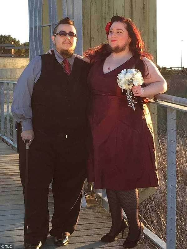 Mắc bệnh lạ, người phụ nữ mọc râu quai nón như đàn ông ảnh 3