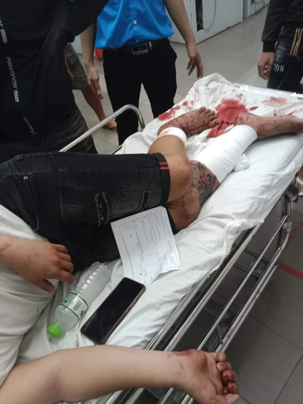 Anh H bị thương ở chân nhập viện tại Bệnh viện đa khoa Long An. Ảnh: CTV Anh H bị thương ở chân nhập viện tại Bệnh viện đa khoa Long An. Ảnh: CTV