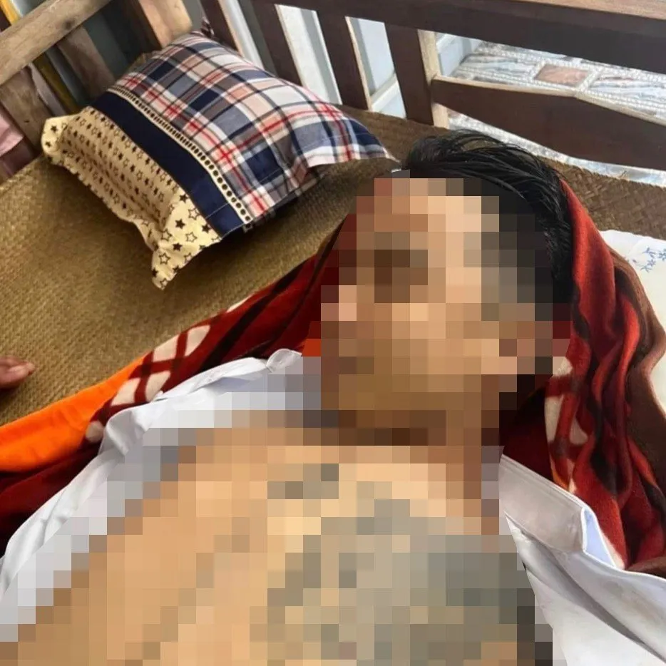 Nạn nhân nghi bị bắn tử vong. Ảnh: CACC Nạn nhân nghi bị bắn tử vong. Ảnh: CACC