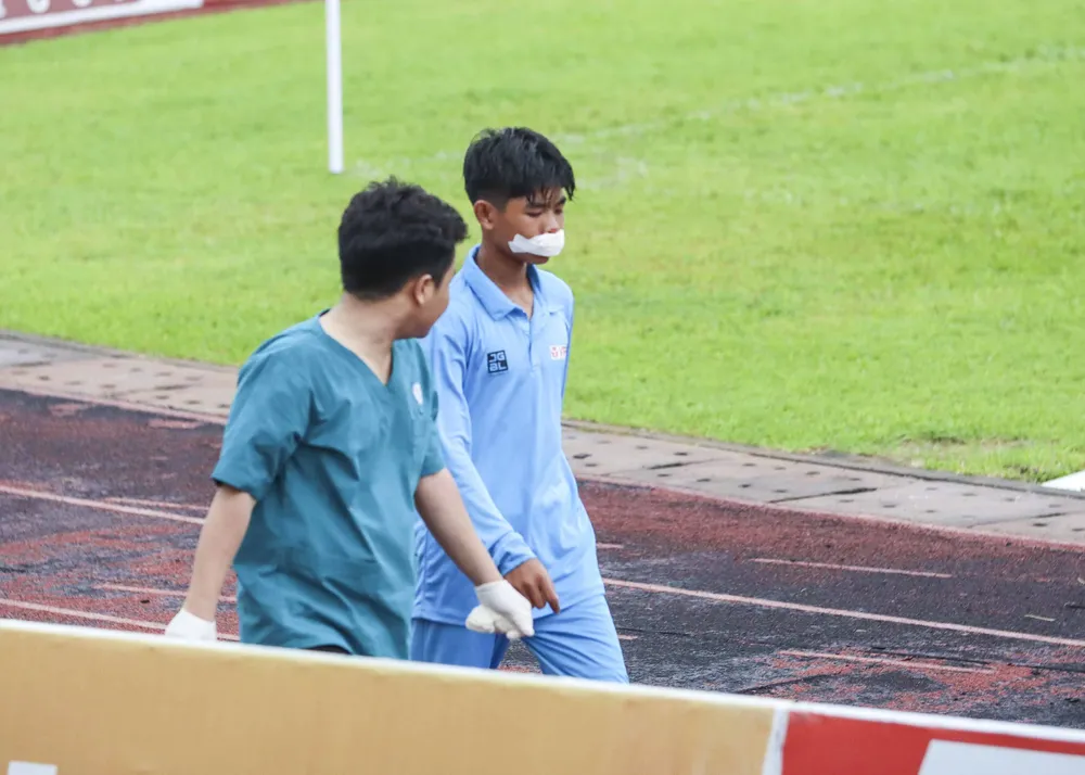 Cậu bé nhặt bóng được các bác sĩ đưa ra khỏi sân để chăm sóc vết thương. Ảnh: HUỲNH DU