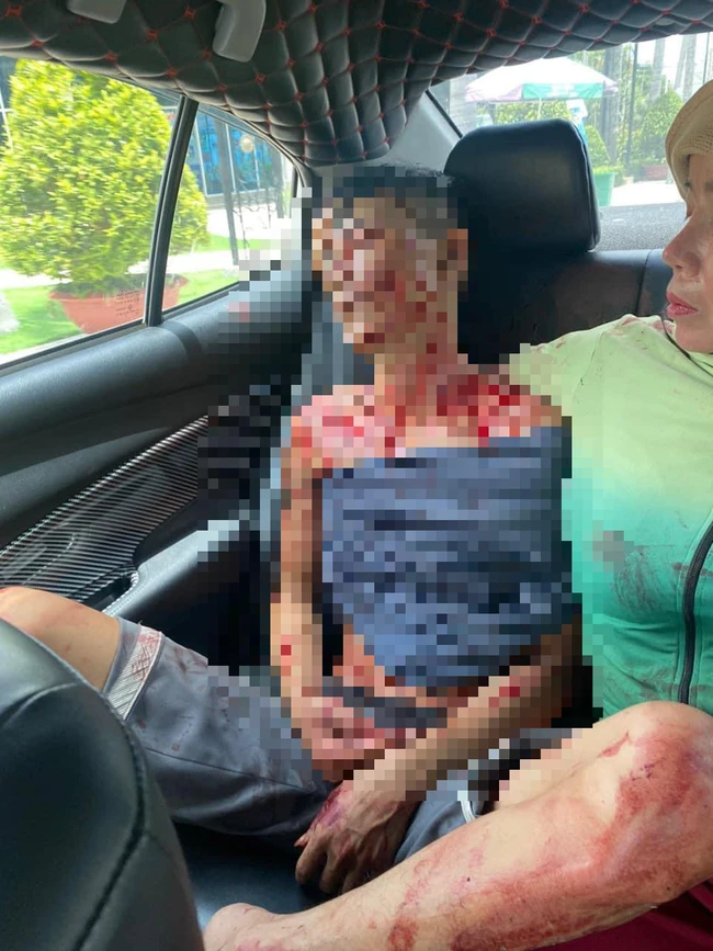 Anh D được người nhà đưa đi cấp cứu trên người nhiều vết dao đâm. Ảnh: NNCC