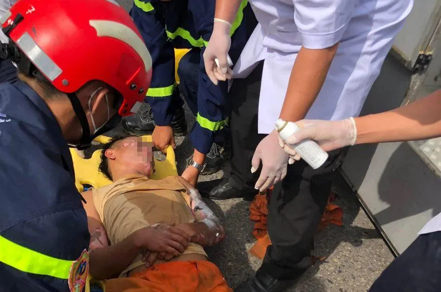 Nam công nhân bị bỏng. Ảnh: H.H Nam công nhân bị bỏng. Ảnh: H.H