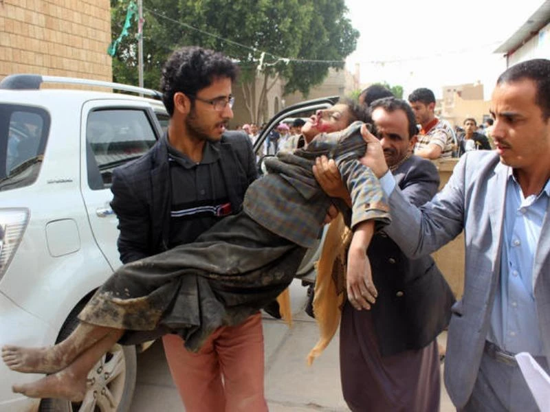 Nạn nhân trẻ em trong trận không kích liên quân Saudi Arabia dẫn đầu thực hiện sáng 9-8 ở Yemen. Ảnh: GETTY IMAGES