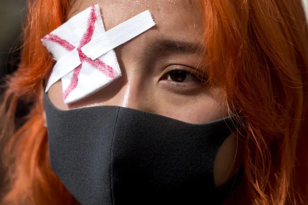 Xuống đường ở TP Vancouver, tỉnh British Columbia (Canada) ngày 17-8 ủng hộ người biểu tình Hong Kong. Ảnh: AP