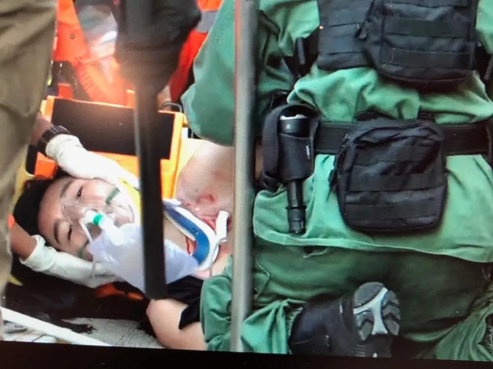 Sinh viên 18 tuổi được đưa đi cấp cứu trong tình trạng nguy kịch. Ảnh: SCMP