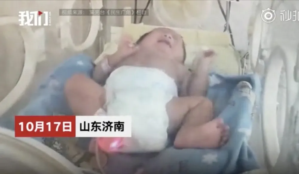 Dù trải qua nghịch cảnh nhưng sức khỏe cậu bé đã tiến triển rất tốt. Ảnh: WEIBO