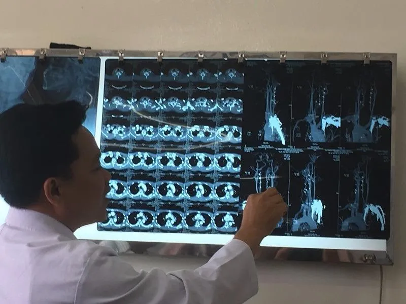 Nếu không được mổ kịp thời bệnh nhân đã tử vong do vỡ mạch máu