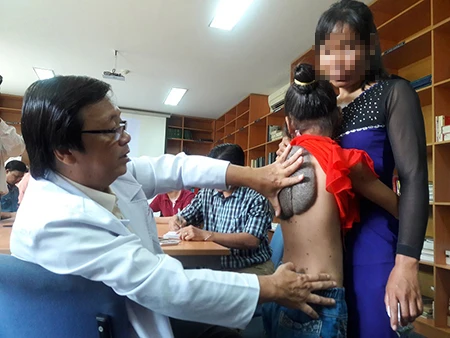 Kỳ lạ cô bé 'lưng rùa' có 232 nốt ruồi trên người ảnh 1