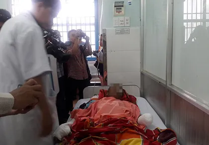 Cuốc đất trồng điều bị mìn nổ phải cắt mất chân ảnh 1