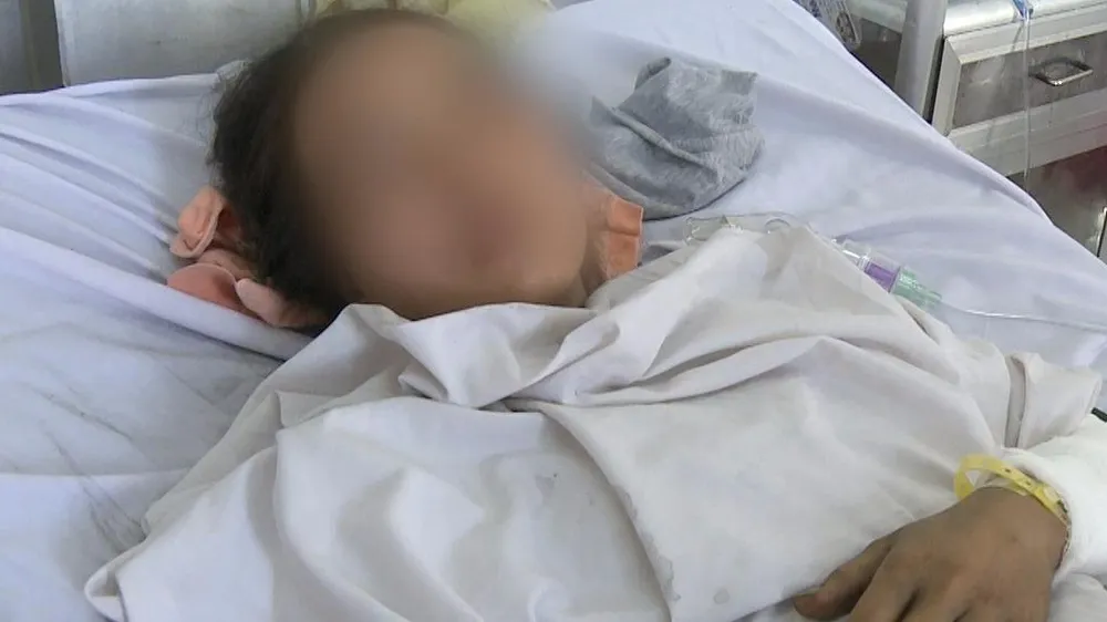 bệnh nhân bị bỏng