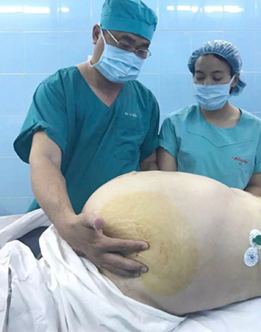 Ngoài cắt bỏ khối u, bệnh nhân còn phải cắt bỏ toàn bộ buồng trứng