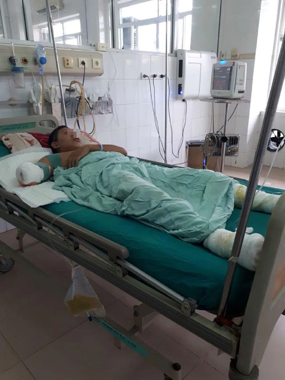 Trèo tường bị điện giật bất tỉnh, phải cắt cụt cánh tay ảnh 1 Trèo tường bị điện giật bất tỉnh, phải cắt cụt cánh tay ảnh 1