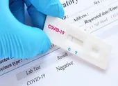 Bộ Y tế tiếp nhận 1.910 tủ bảo quản vaccine và 5 triệu bơm kim tiêm ảnh 3 Bộ Y tế ban hành thông tư hướng dẫn giá xét nghiệm SARS-CoV-2