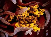 TP.HCM chỉ còn 5 trường hợp nhiễm COVID-19 ảnh 2 Virus gây dịch COVID-19 sống cả giờ ở 60 độ C