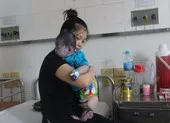 Sản phụ nguy kịch, suýt mất song thai do bị nhiễm bệnh thủy đậu ảnh 2 Mẹ mắc thủy đậu có được cho con bú?