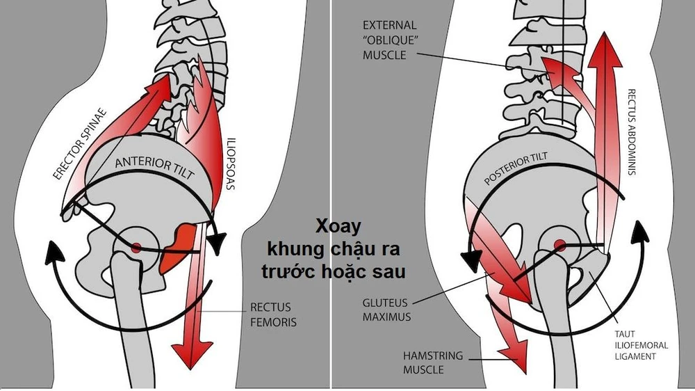 Kỹ thuật điều chỉnh xoay khung chậu để chỉnh đường cong cột sống thắt lưng. Ảnh: BSCC