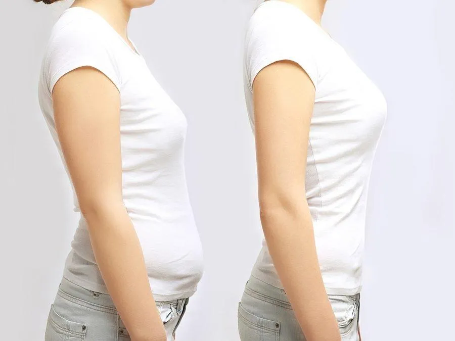 Người bị mất cơ cân bằng cơ thân trên và dưới cùng lúc. Ảnh: BSCC Người bị mất cơ cân bằng cơ thân trên và dưới cùng lúc. Ảnh: BSCC