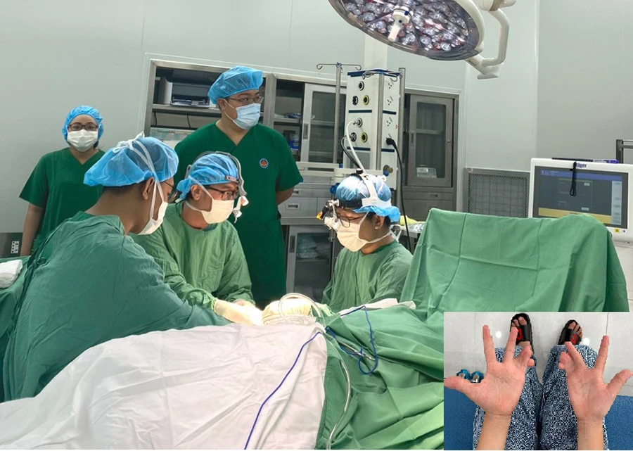 Các bác sĩ đang phẫu thuật tách ngón tay dính liền cho bệnh nhi P (ảnh lớn) và hai bàn “tay cua” của P trước khi phẫu thuật (ảnh nhỏ). Ảnh: BVCC