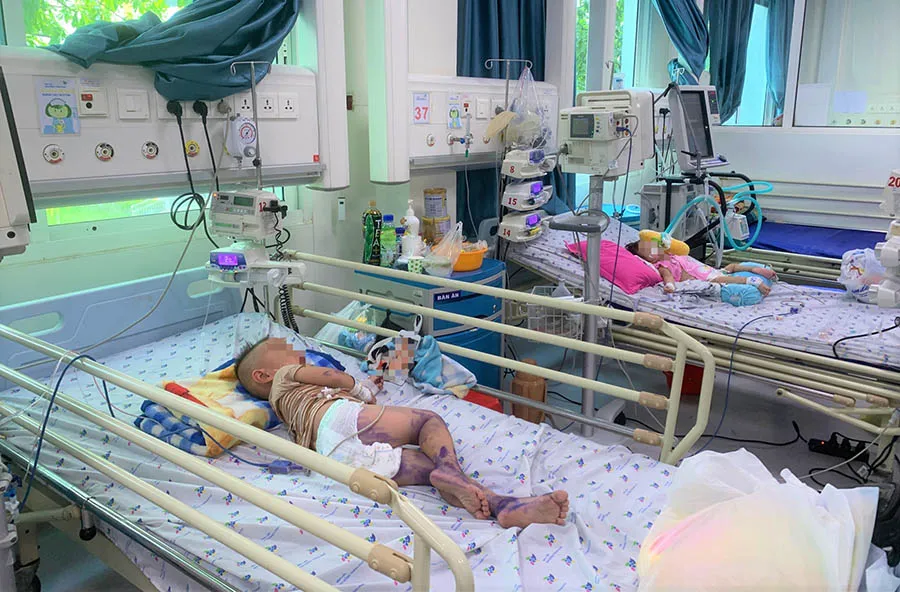 Trẻ mắc tay chân miệng nặng độ II B đang được điều trị tại BV Nhi đồng TP. Ảnh: THẢO PHƯƠNG