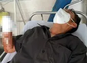 Truy tìm kẻ mặc đồ bảo hộ chém lìa bàn tay người khác ở Bình Dương ảnh 2 Bắt 1 trong 2 người mặc đồ bảo hộ chém lìa bàn tay người khác ở Bình Dương