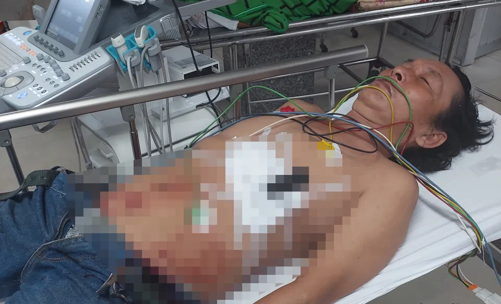 Ông Thống đang được cấp cứu tại bệnh viện trong tình trạng nguy kịch, con dao vẫn đâm ở bụng. Ảnh: LA Ông Thống đang được cấp cứu tại bệnh viện trong tình trạng nguy kịch, con dao vẫn đâm ở bụng. Ảnh: LA