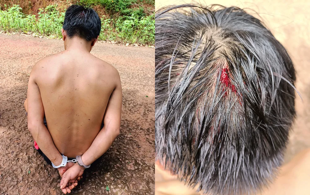 Người dân bị đánh chảy máu đầu và bị còng tay. Ảnh: NDCC