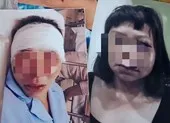 Người đàn ông cắt tai, hành hạ vợ cũ dã man ảnh 2 Khởi tố vụ án chồng đánh vợ dã man ở Quảng Ninh