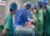 Nghiện rượu 10 năm, thanh niên 28 tuổi tự đâm thấu bụng ảnh 3 Bỏ qua thủ tục, 15 bác sĩ tập trung cứu người bị đâm thấu bụng