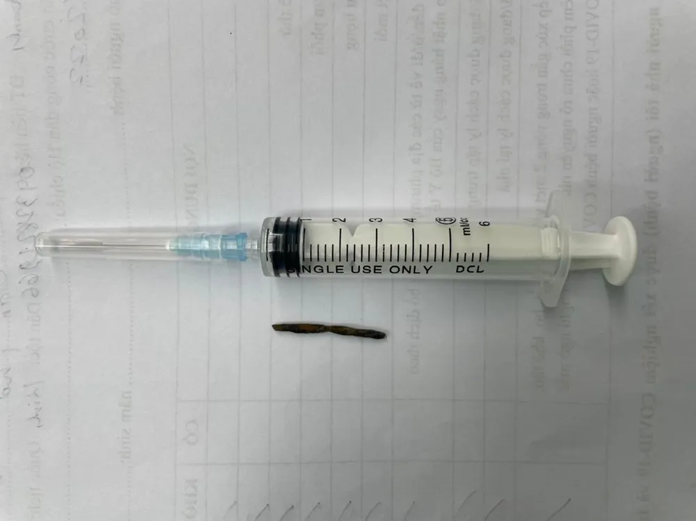 Dị vật lấy ra từ tim bệnh nhân. Ảnh: BVCC