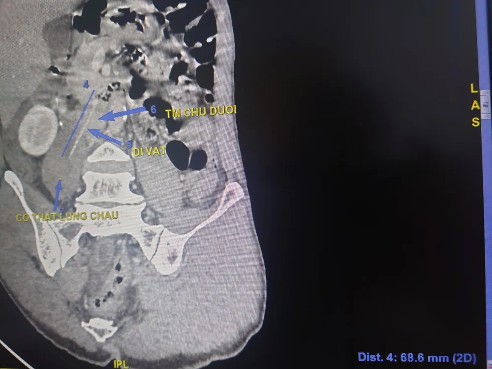 quen ngậm tăm quen ngậm tăm