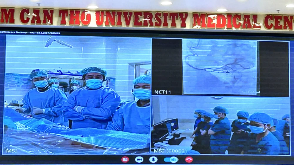 can thiệp tim mạch miền tây