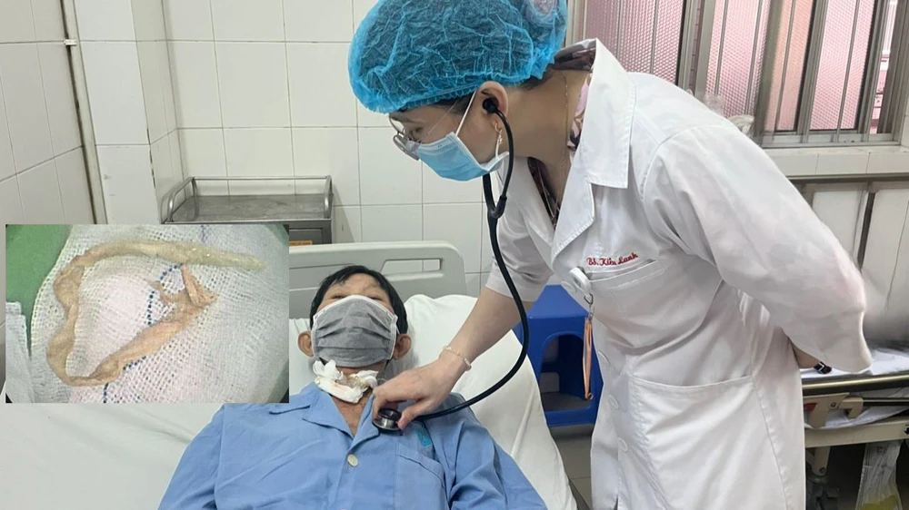 khăn giấy thẩm dịch