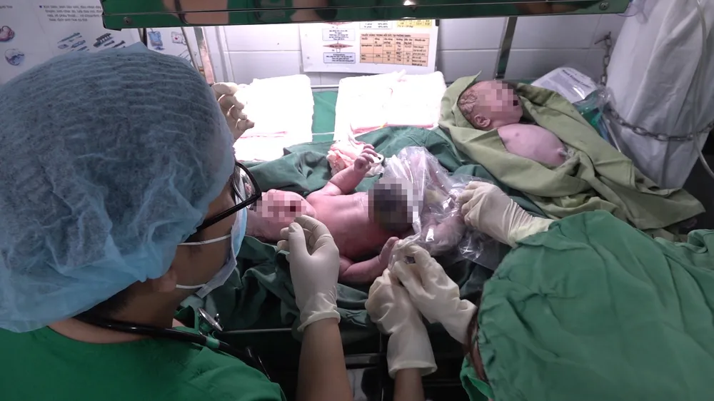 Song thai có khối thoát vị rốn lớn ở bụng được phẫu thuật lấy thai an toàn