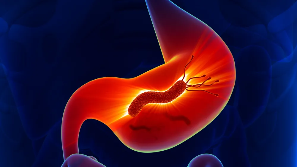 Nguyên nhân khiến dạ dày chẳng ‘yên’ mùa du lịch