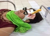 Bị dao đâm xuyên não 6 cm vì trượt chân té khi cạo vôi 