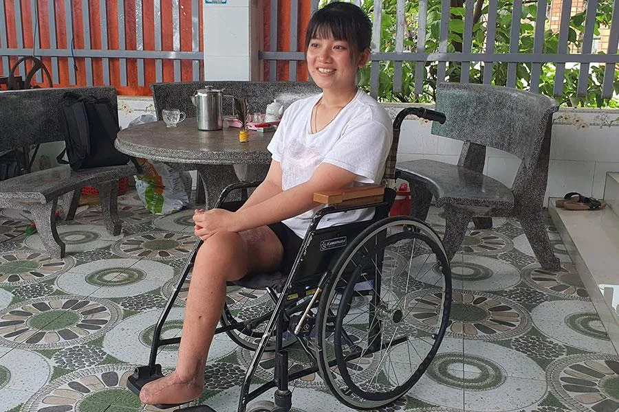 Em Trần Thị Hồng vui mừng khi hay tin có mạnh thường quân giúp lắp chân giả. Ảnh: TK
