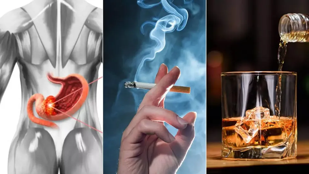 5 thói quen làm tăng nguy cơ mắc ung thư dạ dày