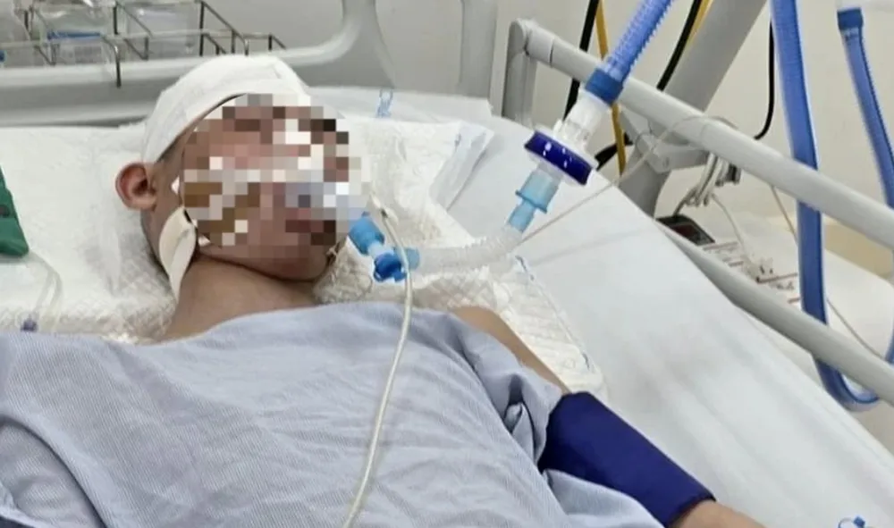 Nam sinh lớp 8 bị đánh khi đang chơi bóng rổ